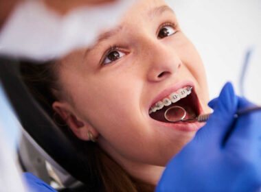 Aparat ortodontyczny u nastolatki - co należy wiedzieć?
