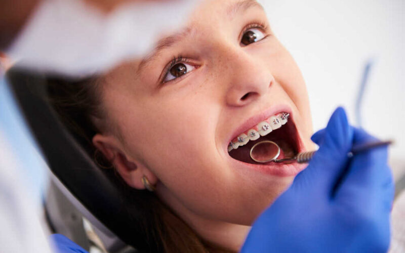 Aparat ortodontyczny u nastolatki - co należy wiedzieć?
