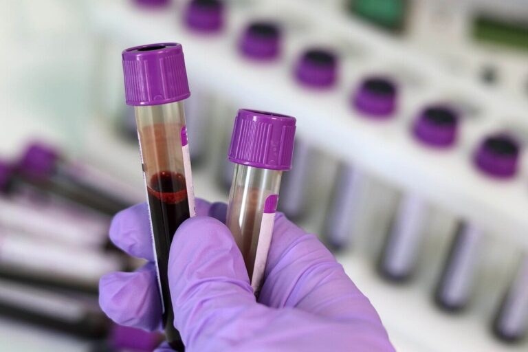 Pobranie krwi w domu